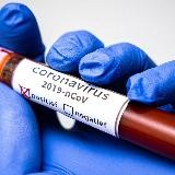 Coronavirus Online | COVID-19