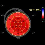 Simple Echocardiography