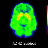 SDVG(ADHD), Blackpill, Science && Shitposting