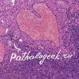 Pathologeek