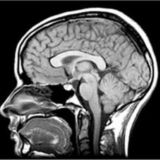 NEUROIMAGING/NEURORADIOLOGY