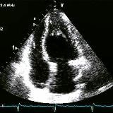 Эхокардиография/Кардиология/Echocardiography/Cardiology🫀👨‍⚕