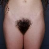 Hairy Women